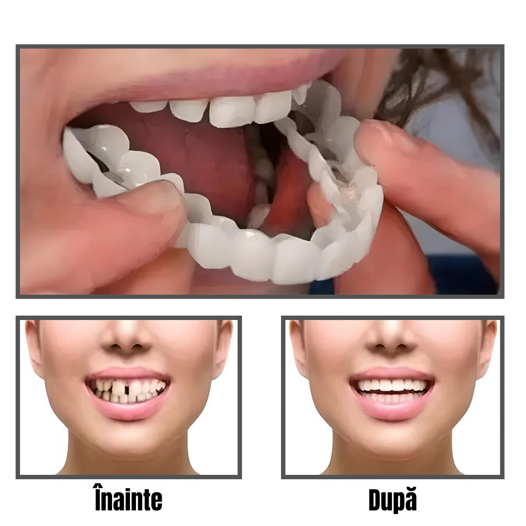 Proteză dentară cosmetică